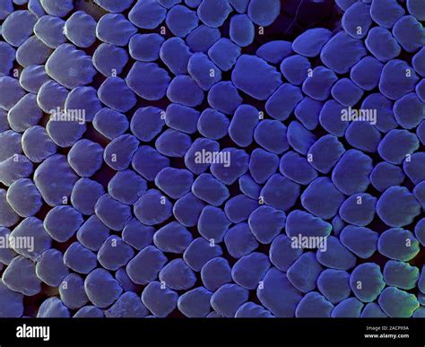 Shark skin. Coloured scanning electron micrograph (SEM) of scales on ...