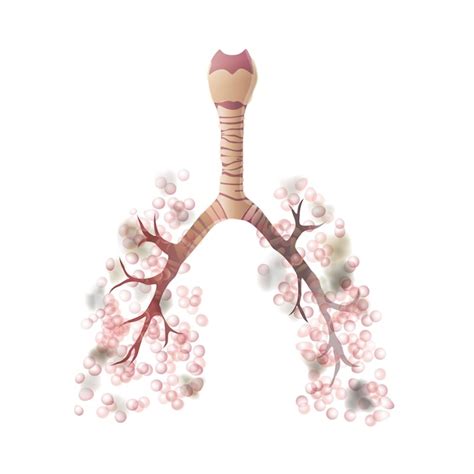 Premium Vector Vector Isolated Illustration Of Lung Anatomy With Cancer Tumor Human