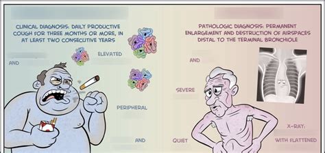 Exam 4: Blue Bloater vs Pink Puffer (Diagram) Diagram | Quizlet