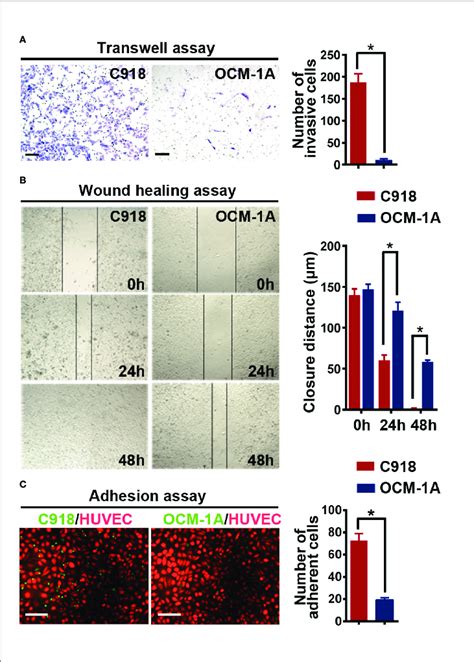 C918 Cells Show Higher Invasionmigration Ability And Stronger