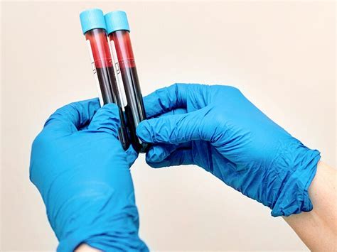 Differential Blood Test Uses Procedure And Results Off