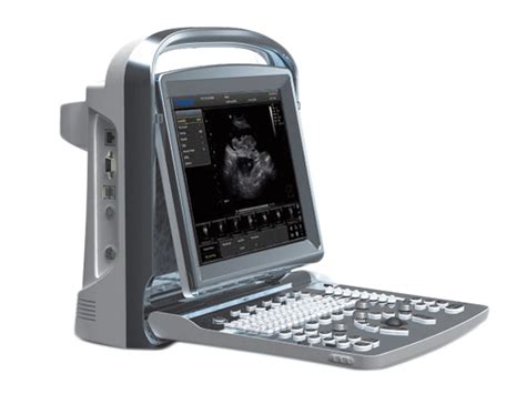 CHISON ECO1 VET Ultrasound Devices For Veterinary Medicine