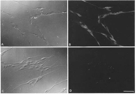 Expression Of Ill And~4 Integrins By Primary Schwann Cells Primary