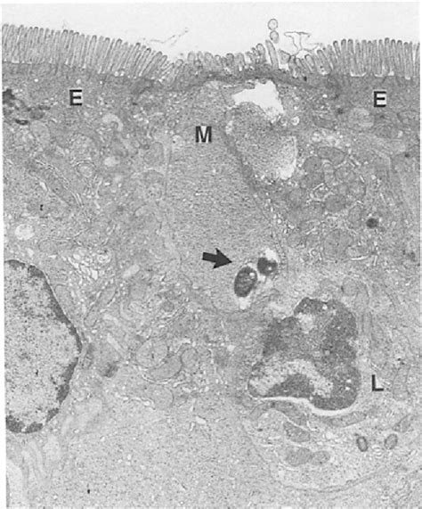 Figure 1 From Salmonella Typhimurium Initiates Murine Infection By