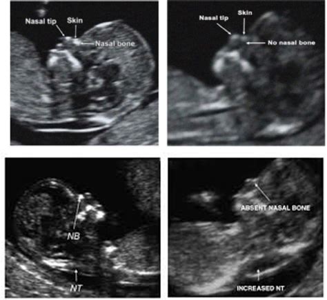 Figure From A Review On Techniques For Computer Aided Diagnosis Of