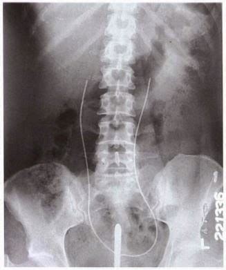 Retrograde Urography - RadTechOnDuty