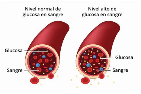 Qu Es La Sangre Conhe A A Emo O De Apostar Panela Brinox