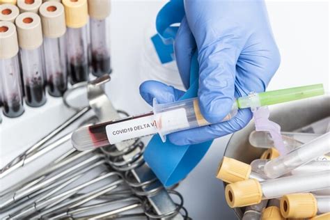 Premium Photo Scientists Hand Holding A Test Tube With Blood Sample