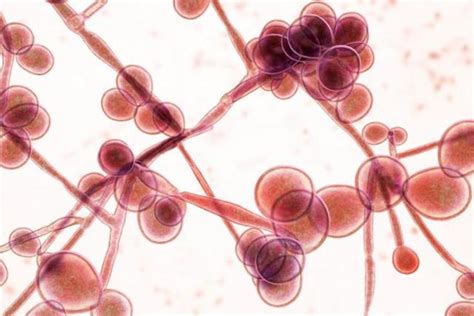 Candida Auris ¿qué Es Cómo Se Contagia Cuáles Son Los Síntomas Y Qué Tan Peligroso Es El