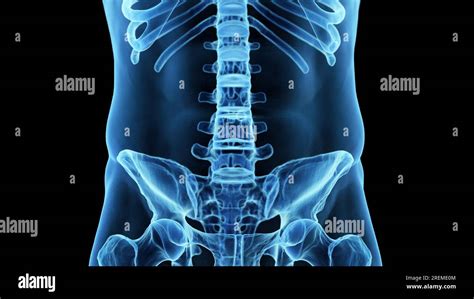 Anatom A Posterior De La Columna Vertebral Medlineplus Enciclopedia