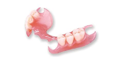 What are Flexible Dentures? - Olds Denture & Implant Centre