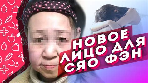 Новое лицо для Сяо Фэн - YouTube