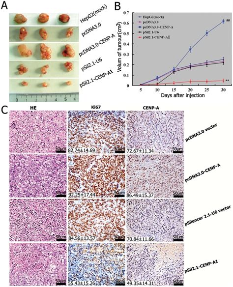 The Transfected Or Untreated HepG2 Cells Were Injected Into Nude Mice