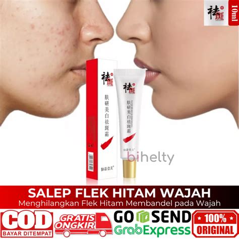 Jual Salep Flek Hitam Wajah Menghilangkan Flek Membandel Krim Melasma