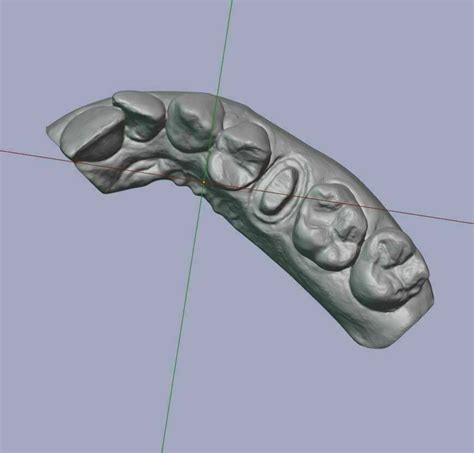 Fichier Stl Gratuit Mod Le Dentaire Avec Matrice Demi Arche B Ddesign