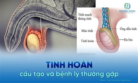 Tinh Ho N L G C U T O Ch C N Ng V Nh Ng B Nh L Th Ng G P