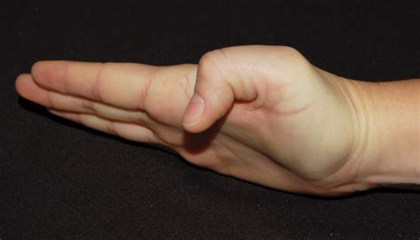 rationale  exercise  thumb cmc osteoarthritis handlab resources