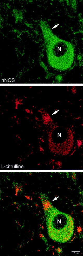 L Citrulline Immunostaining Identifies Nitric Oxide Production Sites