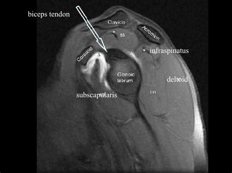 Mri Slides Second Yr Students 2008