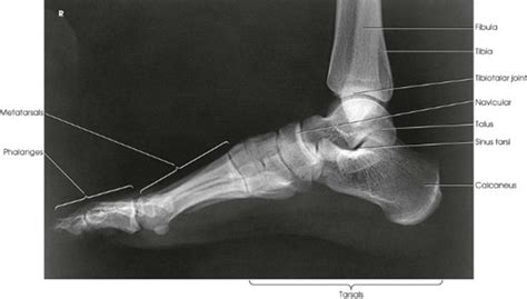 Lower Limb Lateral Foot Diagram Quizlet