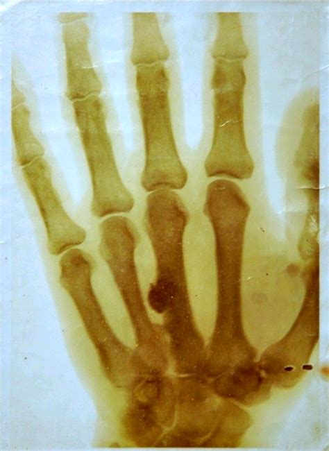 The Oldest X Ray Image In Serbia Taken In It S Displaying The