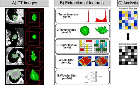 Ct Based Radiomic Signature Predicts Distant Metastasis In Lung Adenocarcinoma Radiotherapy