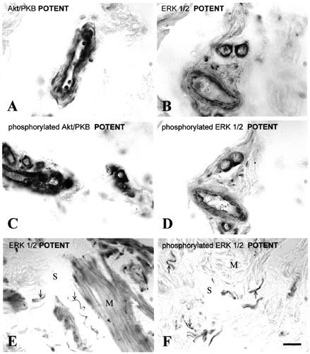 Endothelial cells and smooth muscle cells from small arteries in the ... 