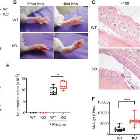 Pd 1h Ko Mice Develop More Severe Pristane Induced Inflammatory