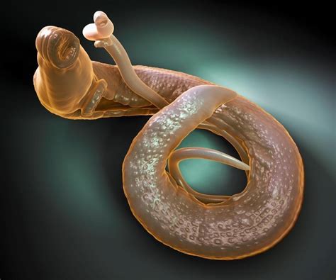 What Is Schistosomiasis What Are The Symptoms Of Bilharzia And How Is