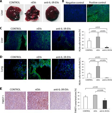 Effect Of Nevs And Anti Il 3r Evs On Metastases Generated From Primary