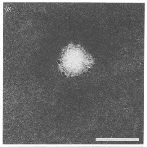 Immunoelectron Micrographs Of Virus Like Particles From Plasma Samples