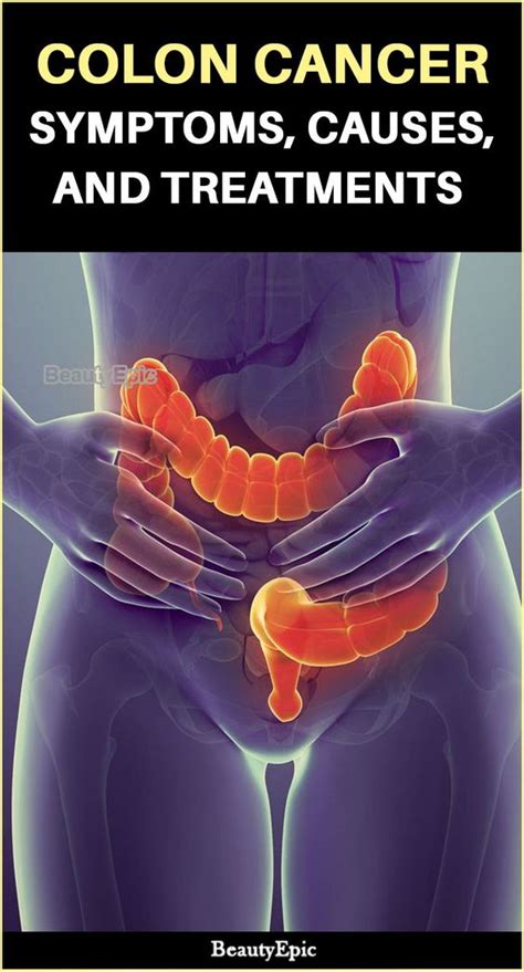 Colon Cancer Symptoms Causes And Treatments Healthy Optimum