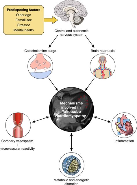 Takotsubo Cardiomyopathy Causes