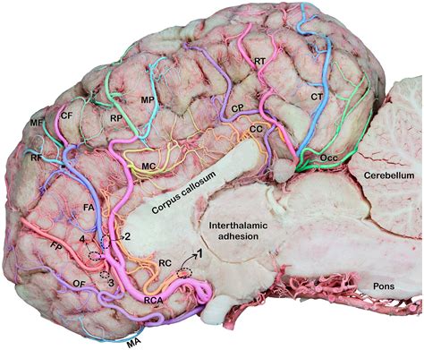 frontiers comprehensive analysis   rostral  caudal cerebral