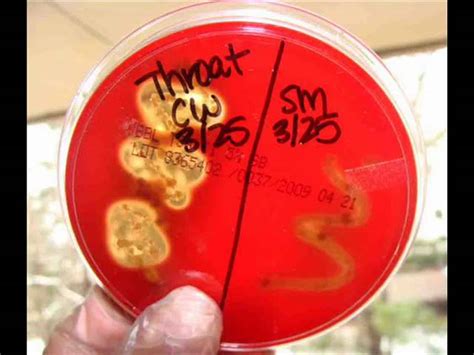 Blood Agar Alpha Beta Gamma