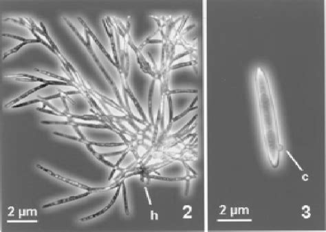 Trichomycetes Alchetron The Free Social Encyclopedia