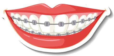 Teeth With Braces On White Background 4341648 Vector Art At Vecteezy