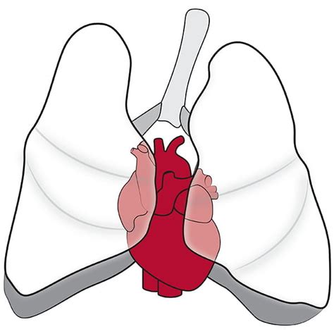 Home Division Of Cardiothoracic Surgery Washington University In St