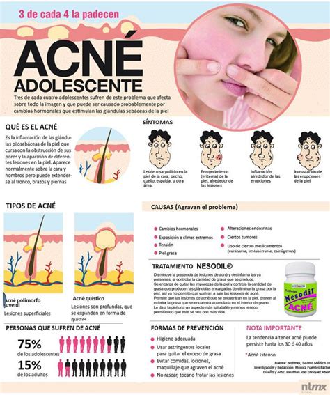 15 Infográficos Para Combatir El Acné De Una Vez Por Todas Acne Bad