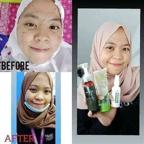 Jual Paket Glowing Naturaworld Original Nav Ncs Nbs Shopee Indonesia