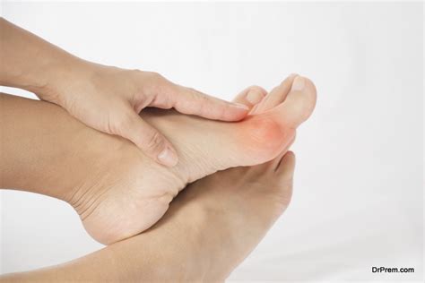 Common Foot Conditions And Treatment