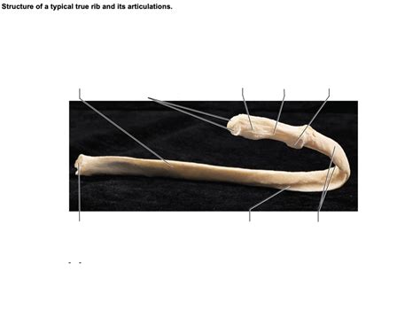 Structure Of Typical True Rib Diagram Quizlet