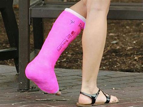 Cast Kit - Short Leg - Fiberglass - A-1 Medical Integration