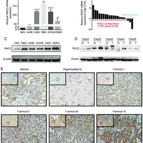 Rac Was Up Regulated In Rcc Cells And Tissues A And B Reverse