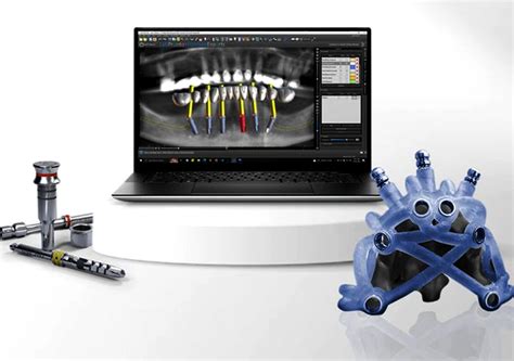 Virtual Surgical Planning Vsp Dental Implantology Precision Enhanced