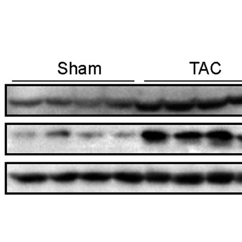 Runx Expression In Cardiac Hypertrophy A Representative Mrna Levels