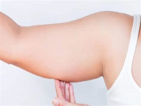 Arm Fat मोटापे के अलावा ये 4 कारण भी हो सकते हैं बाजू पर चर्बी का कारण