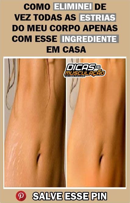 Como Eliminei De Vez Todas As Estrias Do Meu Corpo Apenas Esse