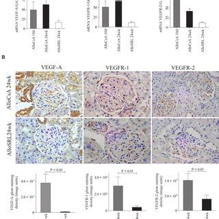 Glomerular Expression Of Vegf Vegfr And Vegfr Mrna And Protein