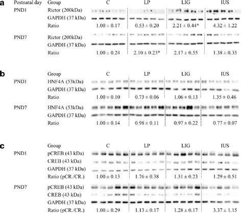 Western Blot Analyses Of A Rictor Upper Part Of Figure B Hepatic